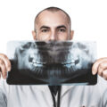 Είναι ασφαλείς οι οδοντικές ακτινογραφίες;