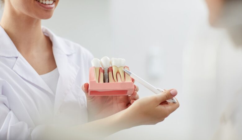 Πώς ένα οδοντικό εμφύτευμα αντικαθιστά ένα δόντι που λείπει